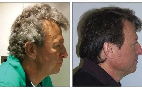 Homem de perfil com cabelo grisalho e, ao lado, o mesmo perfil com o cabelo escuro